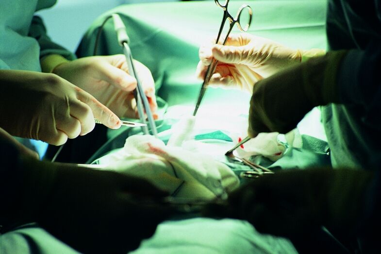 surgical increase in penis thickness